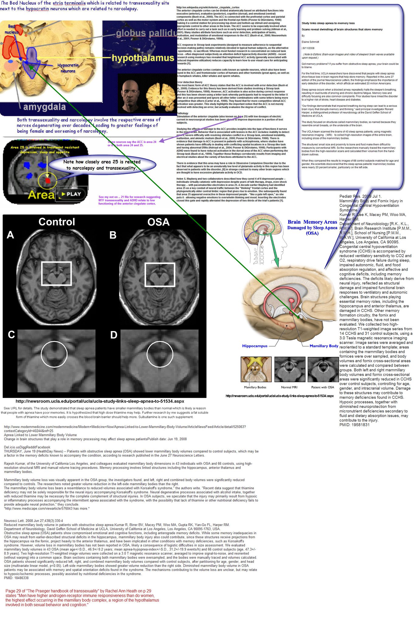 ./Nerissa - Brain chart - 279040_10150257388122888_778437887_7419170_7046_o.jpg